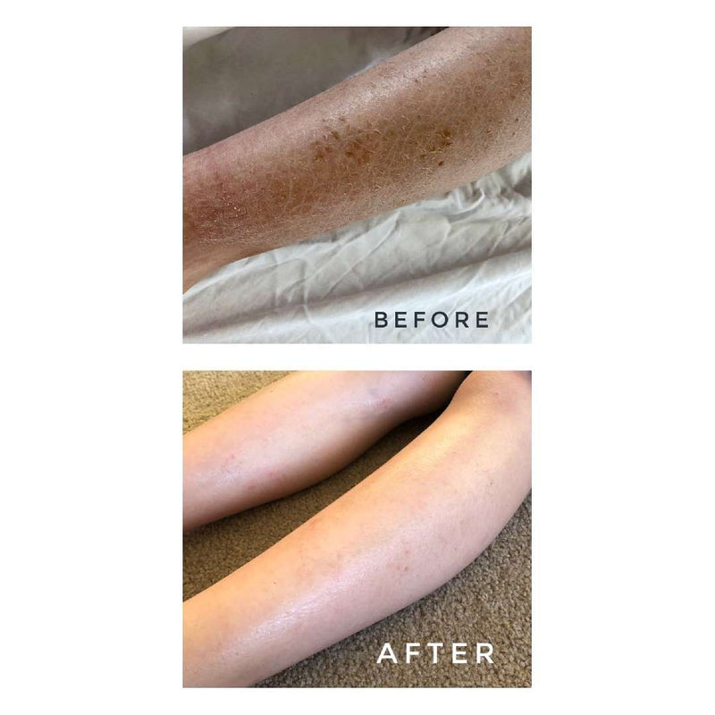 Melvory - CALENDULA GOLDEN MILK BATH