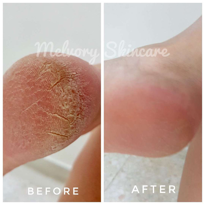 Melvory - LAVENDER COCOA BUTTER